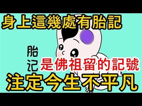 腳底胎記|腳底紅胎記：可能的併發症